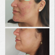 Miniatura de galería