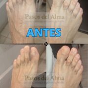 Miniatura de galería