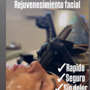 Miniatura de galería